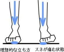 スネの痛み 藤沢で10年 女性の体に特化した痛みをとる整体 まごのて庵